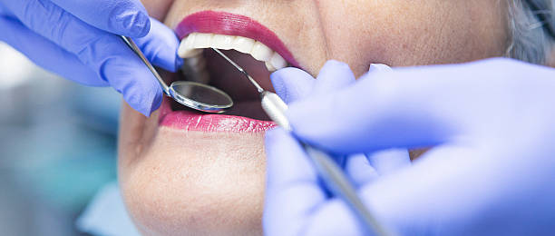 Best Emergency Dentist for Lost Fillings or Crowns in Sicklerville, NJ
